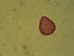 Sparganium angustifolium pollen