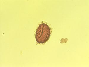 Diplazium subobtusum pollen