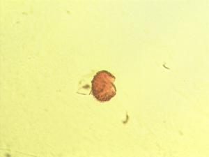 Hyphaene guineensis pollen