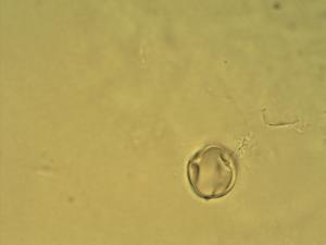 Oxytropis coerulea pollen