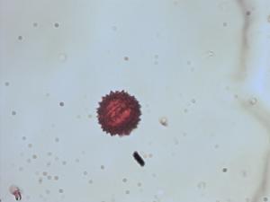 Erigeron polycephalus pollen