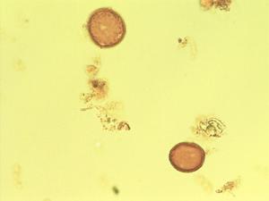 Plantago galapagensis pollen