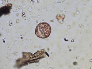 Brassica nigra pollen