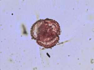 Drosera rotundifolia pollen
