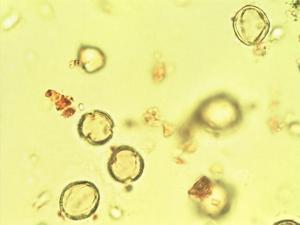Leiospermum pollen