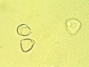 Pollen from the plant Genus Ugni.