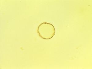 Celtis tessmannii pollen