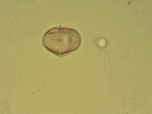 Oxytropis adamsiana pollen