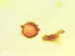 Pterygota bequaertii pollen