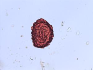 Dryopteris mindshelkensis pollen