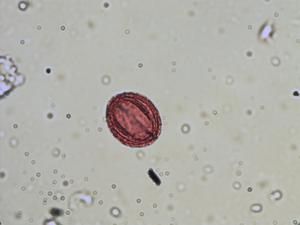 Anemone sylvestris pollen