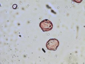 Potentilla grandiflora pollen