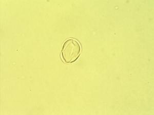 Pollen from the plant Genus Russelia.