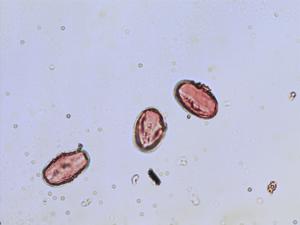 Pollen from the plant Genus Aesculus.