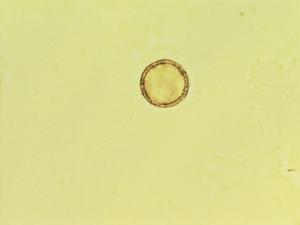 Thalictrum petaloideum pollen
