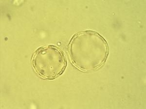 Celosia anthelminthica pollen