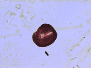Pollen from the plant Genus Diplotaxis.