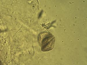 Anacamptis pyramidalis pollen