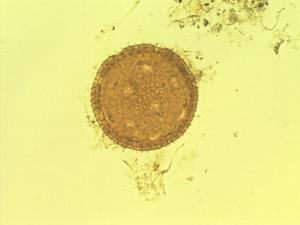 Boerhavia coccinea pollen