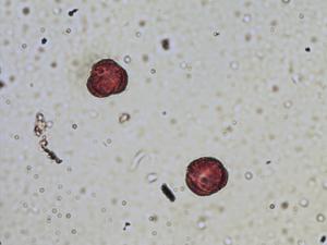 Lepidium latifolium pollen