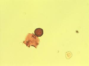 Phytolacca rugosa pollen