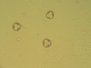 Vicia multicaulis pollen