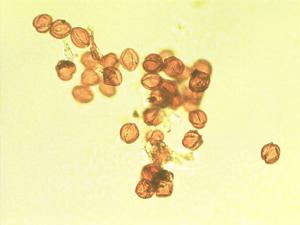 Globularia salicina pollen