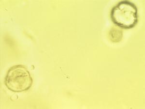 Premna mooiensis pollen