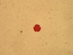 Pollen from the plant Genus Carlina.