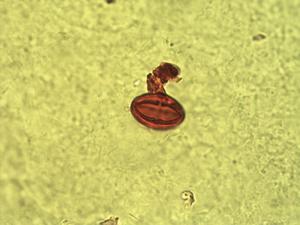 Homalium stipulaceum pollen