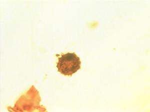 Pollen from the plant Genus Asplenium.
