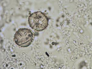Anemone pulsatilla pollen