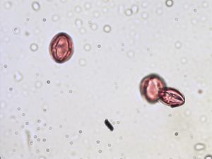 Hypericum androsaemum pollen