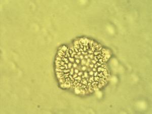 Pollen from the plant Genus Dicoryphe.
