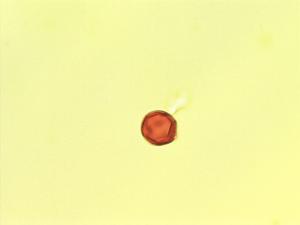 Irvingia pollen