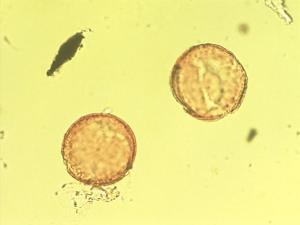 Berberidaceae pollen