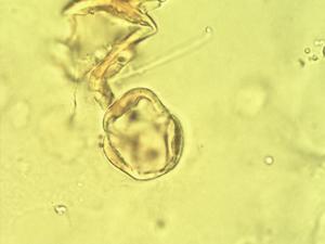Pollen from the plant Genus Acer.