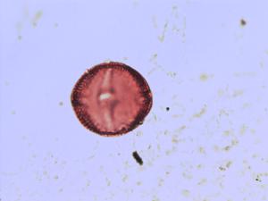 Staphylea pollen