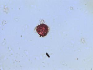 Hieracium pollen