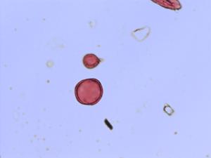 Pedicularis verticillata pollen