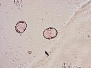 Symphytum pollen