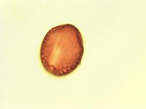 Pollen from the plant Genus Abrus.