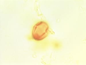 Crotalaria axillaris pollen