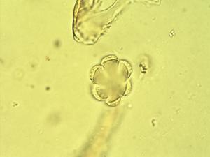Hyptis pollen