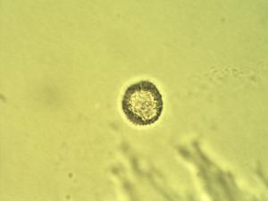 Pollen from the plant Genus Acalypha.