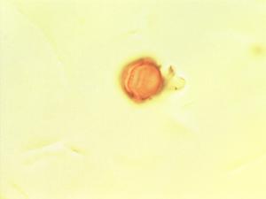 Anopyxis klaineana pollen