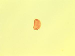 Nephrolepis undulata pollen