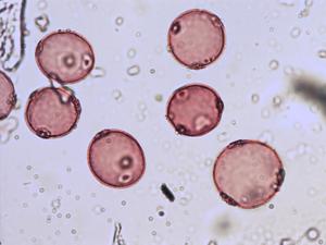 Pollen from the plant Genus Cannabis.