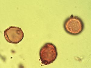 Hymenocardia acida pollen