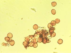 Adenocarpus foliolosus pollen